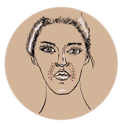 Neuslippenplooi
