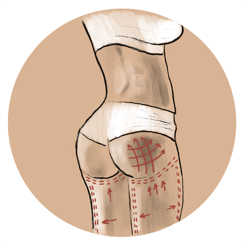 Buttox Butt Lift